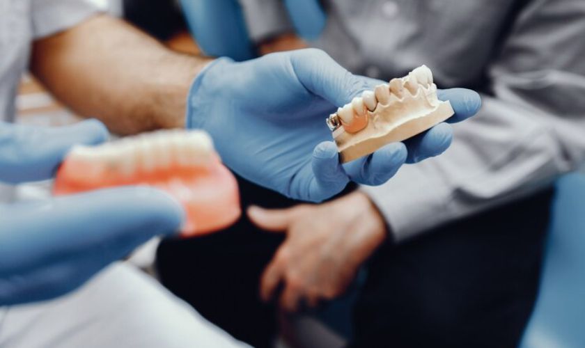 Teeth Need Dental Crowns